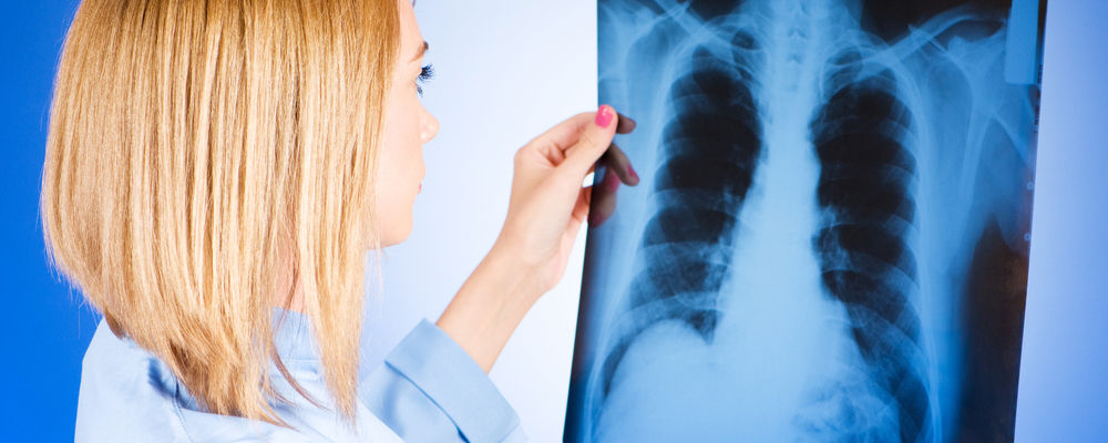 Туберкулез